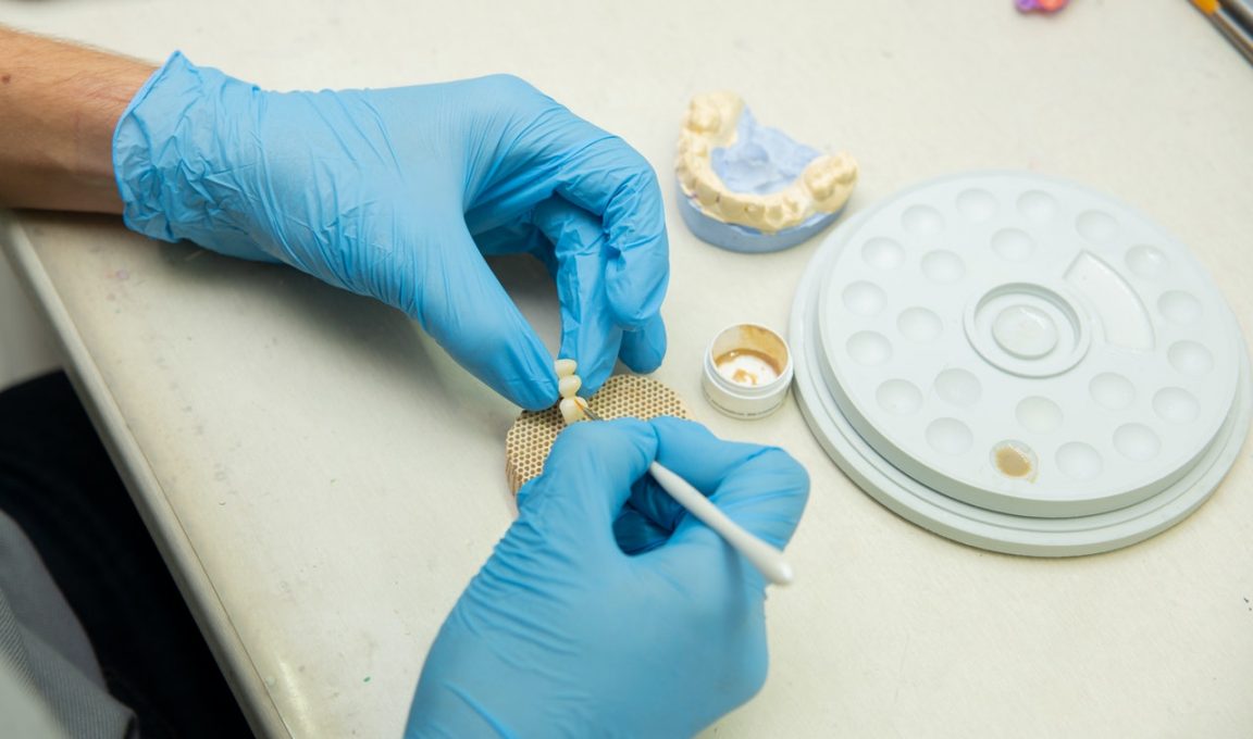 Kurs protetyki na implantach – dlaczego go potrzebujesz?